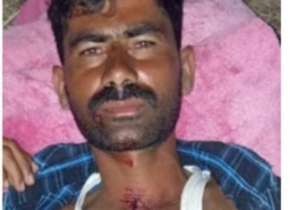 बिबट्याच्या हल्यात मेंढपाळ जखमी,पोंभुरणा तालुक्यातील घनोटी येथील घटना