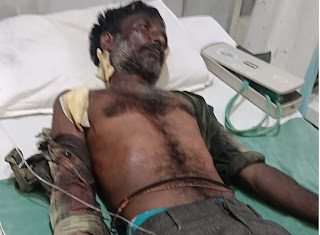 मेंढपाळावर वाघाने केला हल्ला; मेंढपाळ गंभीर जखमी